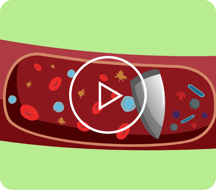 videos-slider-02 Non-Hodgkin Lymphoma