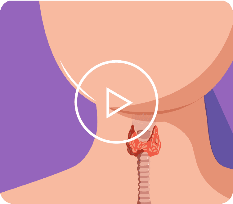 videos-slider-05 Thyroid Cancer